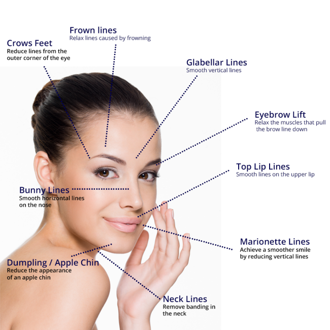 The Ultimate Botox Guide