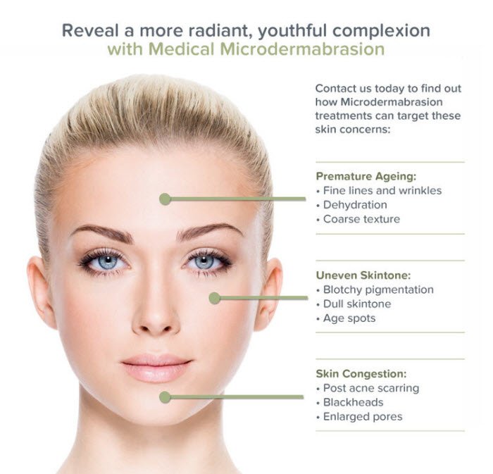 Microdermabrasion Glendale California