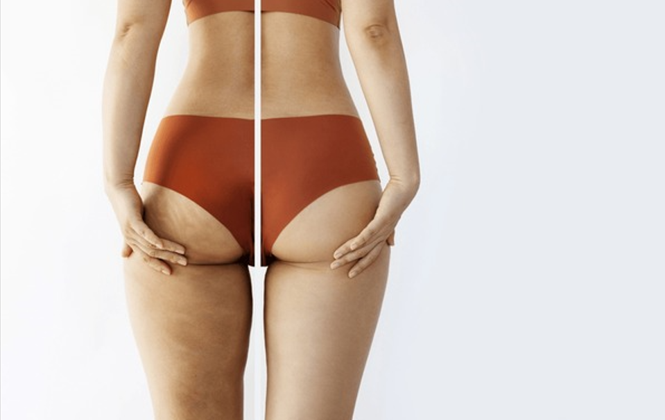 Advanced ISR Treatment Los Angeles