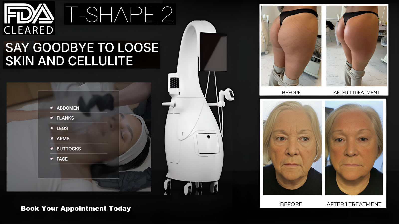 T-Shape-2-Glendale-California