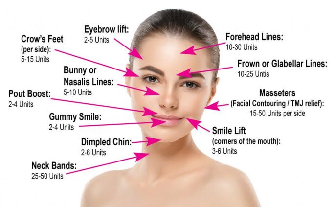 Botox Glendale CA