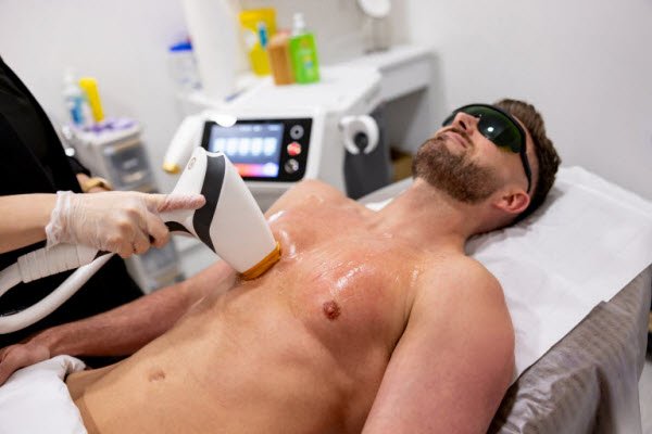 Laser hair removal Glendale CA