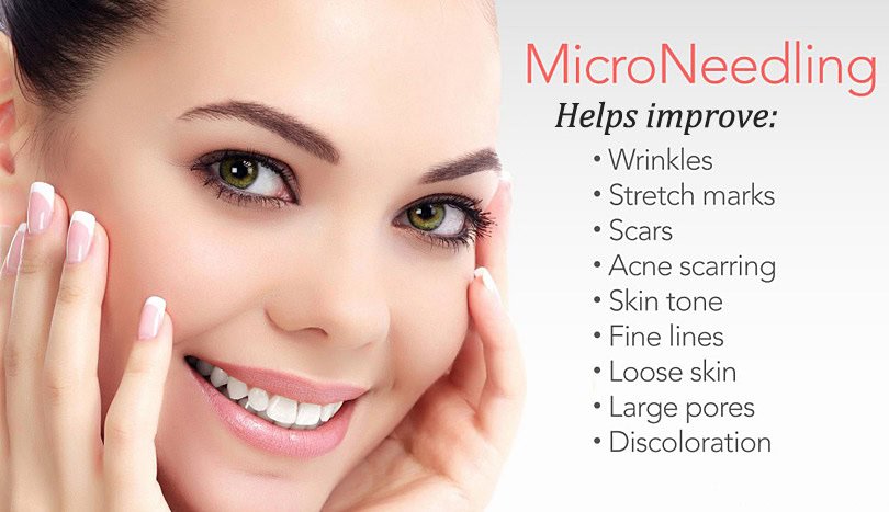 microneedling Glendale