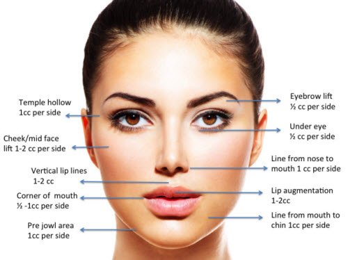 Dermal Fillers Glendale