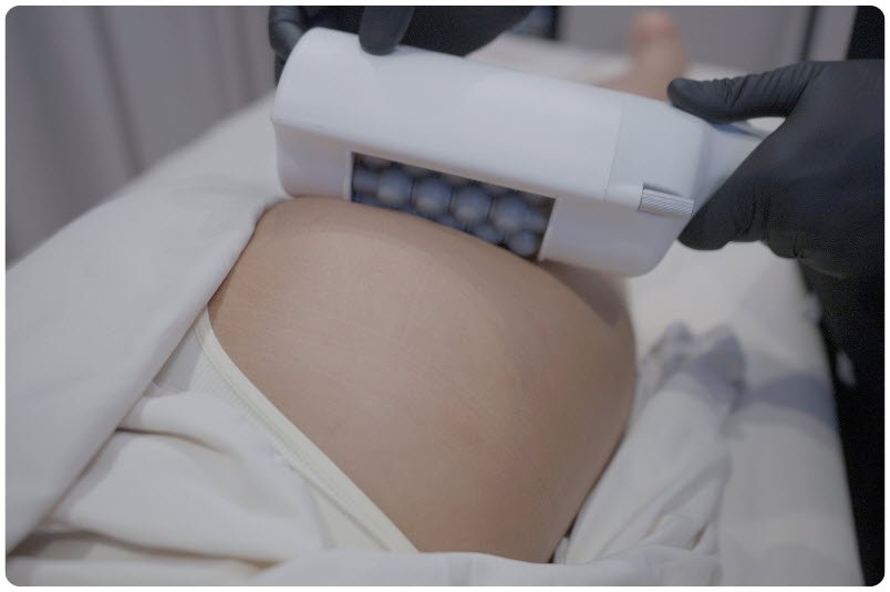 t-shape-2-treatment